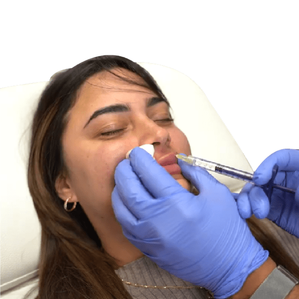 Lip Fillers Lake Worth Fl