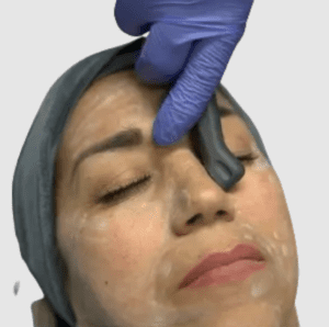 Saltfacial In Lake Worth Fl
