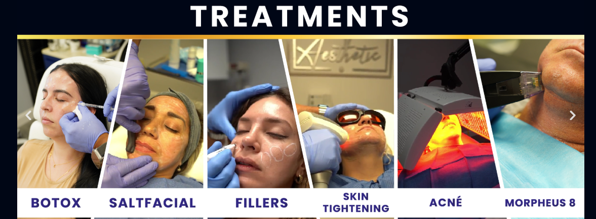 Skin Tightening treatments